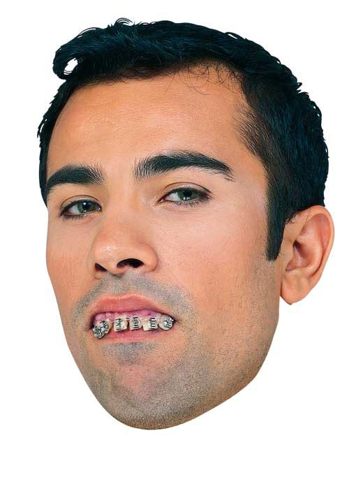 Fake Teeth With Braces 5.95 Unique Gifts and Fun